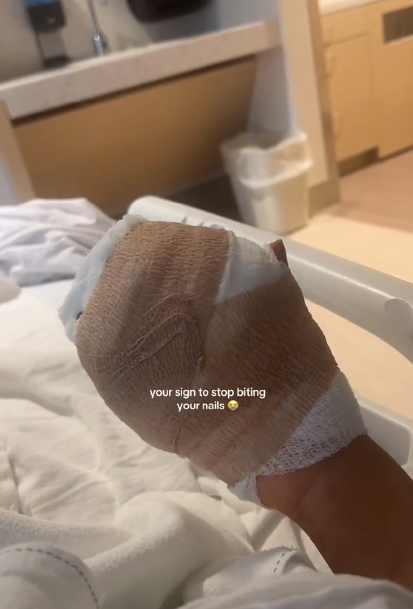 Bandaged hand of woman in hospital